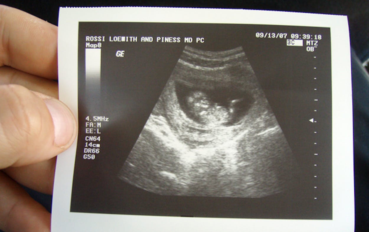 Photograph of a sonogram required for abortion.