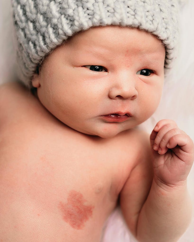 Baby with Texas-shaped birthmark