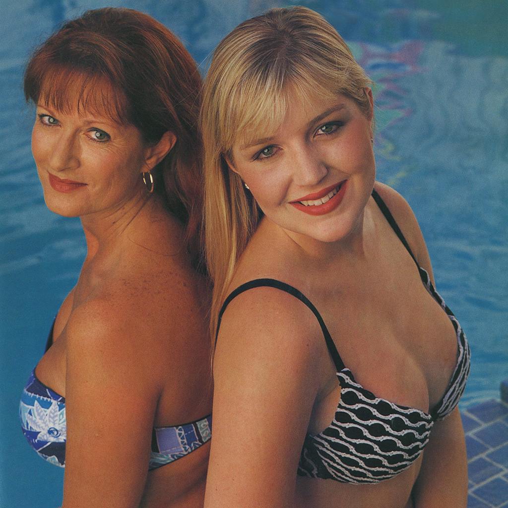 Mother and daughter with silicone implants. 
